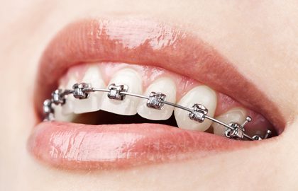 Ortodontia aplicada a Prótese